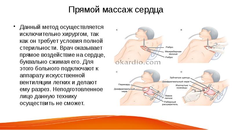 Презентация прямой массаж сердца