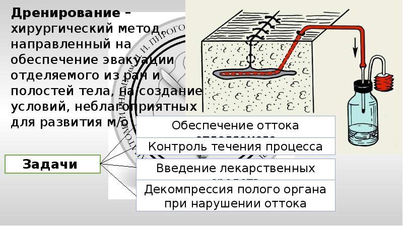 Уход за дренажем презентация