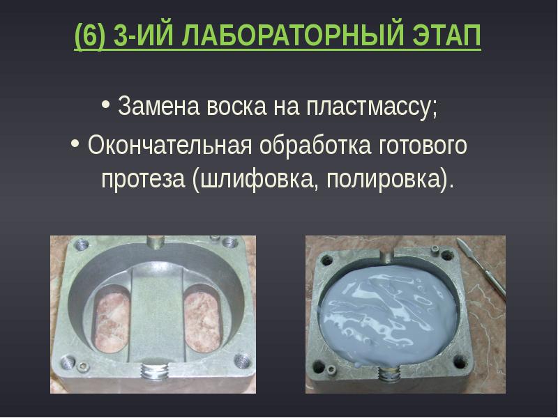 (6) 3-ий лабораторный этап
Замена воска на пластмассу;
Окончательная обработка готового (6) 3-ий лабораторный этап
Замена воска на пластмассу;
Окончательная обработка готового