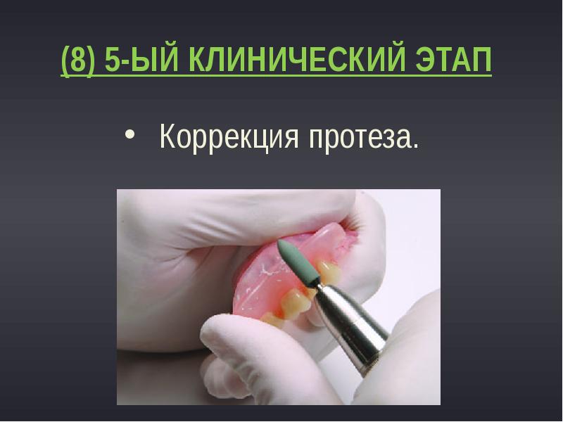 (8) 5-ый клинический этап
Коррекция протеза. (8) 5-ый клинический этап
Коррекция протеза.