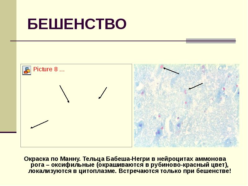 Тельца негри. Тельца Бабеша негри при бешенстве. Окрашивание по манну. Зерна Бабеша Эрнста.