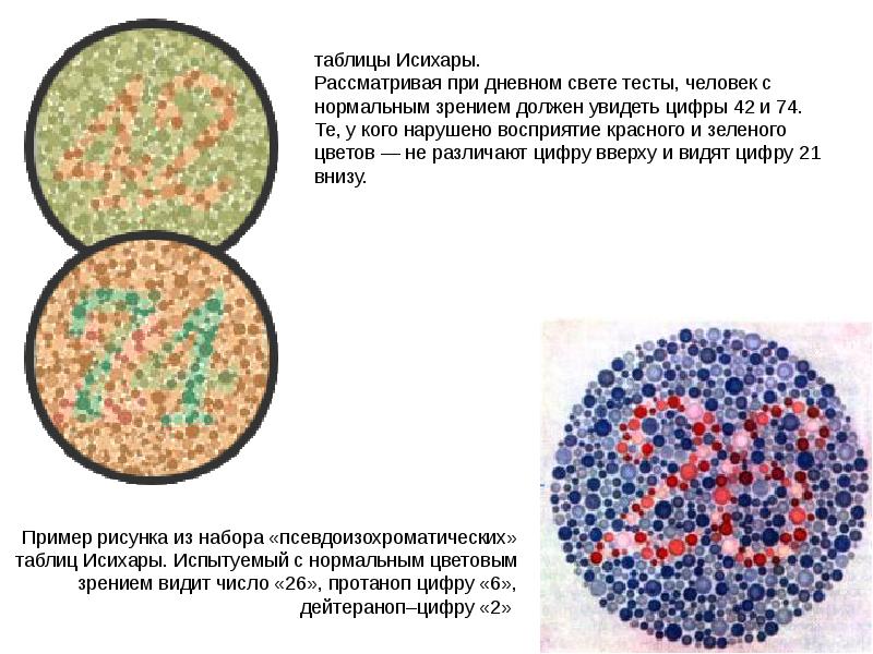 Рассмотрите рисунок 138 укажите у кого из пациентов зрение нормальное и какими нарушениями зрения