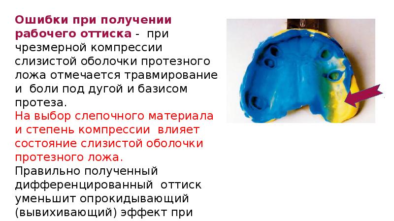 Методика получения оттисков. Получение рабочего оттиска. Оттиск в стоматологии. Двухфазный двухэтапный оттиск. Получение рабочего оттиска.