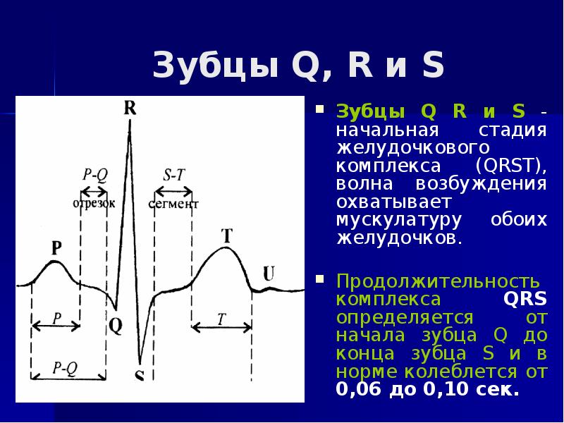 Нормальная экг схема описания реферат