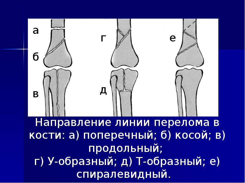 Какой сустав изображен. Рентгенодиагностика травм костей. Травматические повреждения костей. Лучевая диагностика костей и суставов. Какой сустав изображён на рентгеновском снимке.
