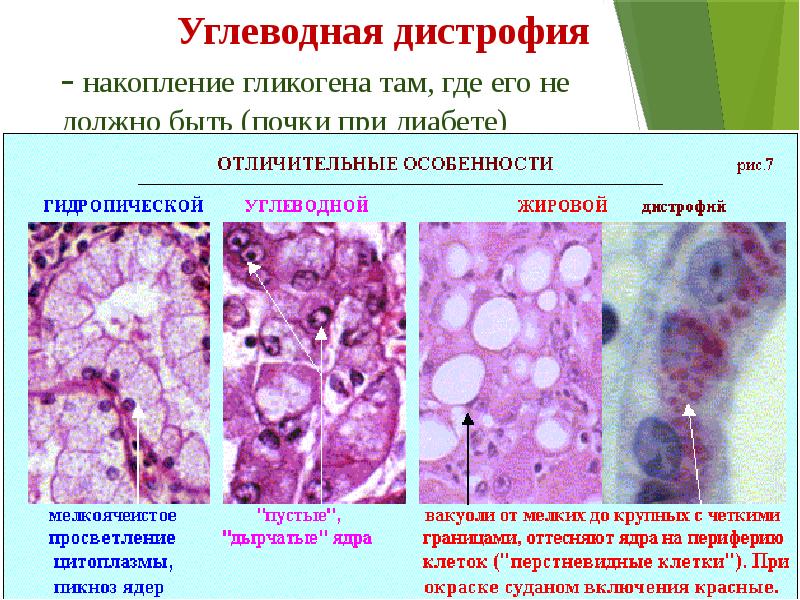 Презентация экстремальные состояния основы патологии