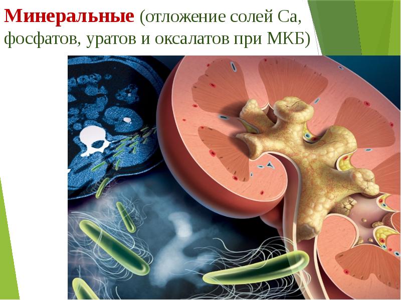 Нарушение водного обмена патология презентация