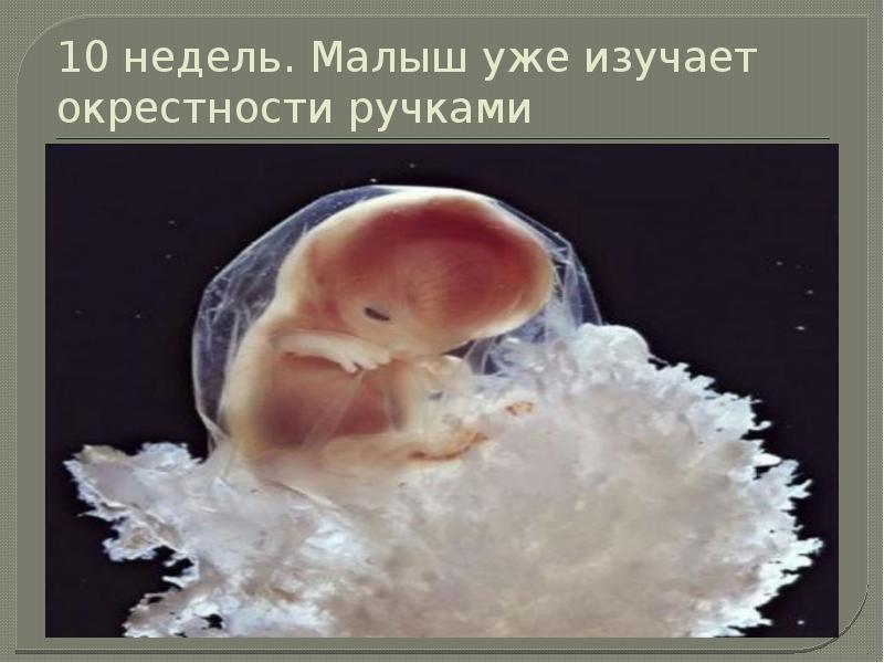Малыш на 10 неделе беременности фото