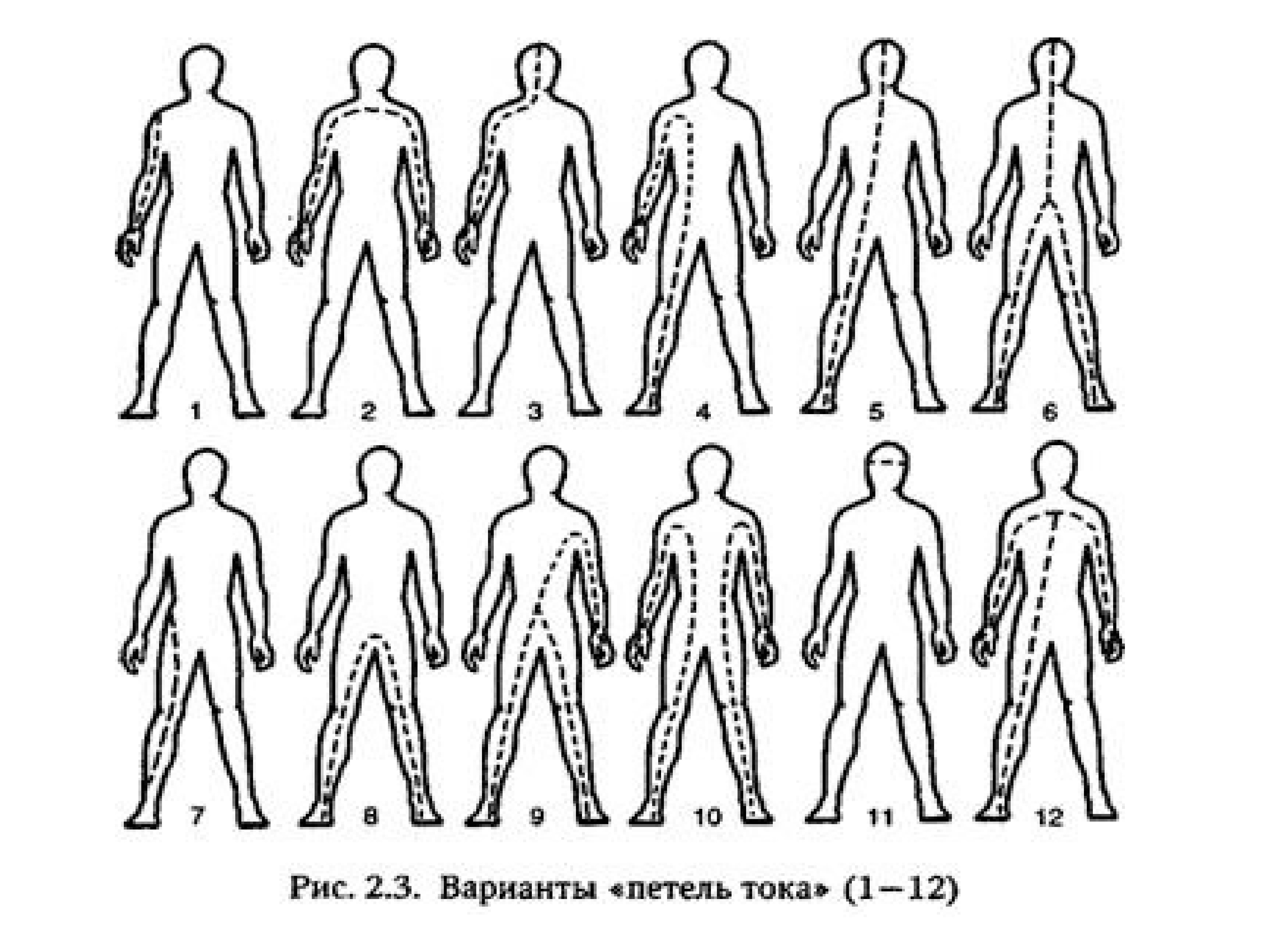 Тело тока. Петли тока в теле человека. Верхняя петля прохождения тока. Какой схемы прохождения электрического тока через тело не существует.