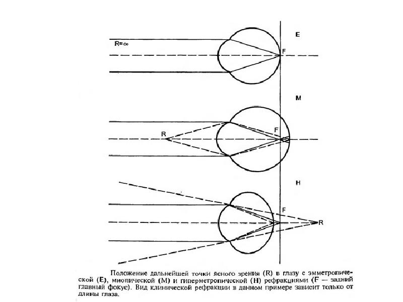 Точка зрения понятна. Физиология зрения схема рефракции. Динамическая рефракция глаза это. Аккомодация при различных видах рефракции. Физиологическая оптика рефракция и аккомодация.