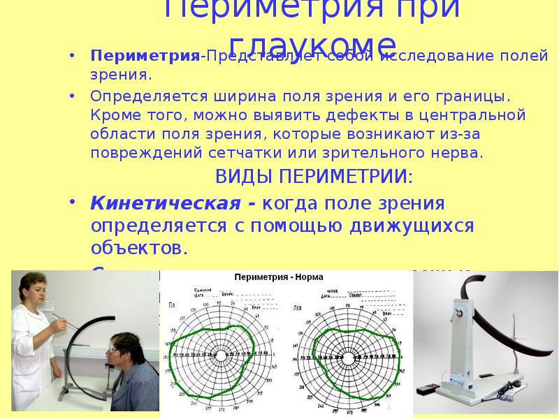 Периметрия в офтальмологии. Исследование полей зрения периметрия норма. Расшифровка компьютерной периметрии глаза. Статическая периметрия норма. Кинетическая периметрия глаза.