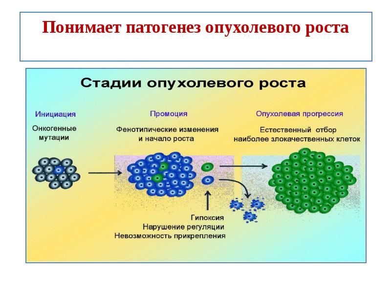 Подпишите картинки виды опухолевого роста