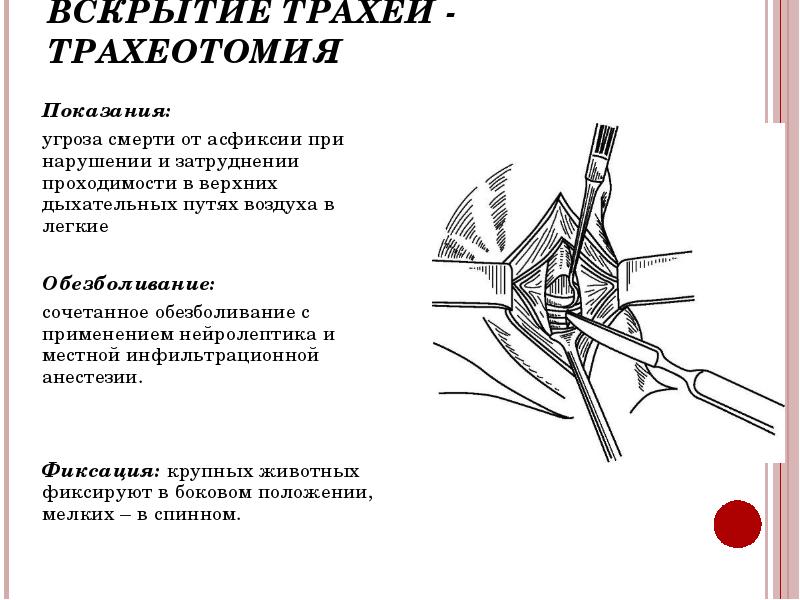 Трахеотомия. Показания к трахеотомии. Трахеотомия и трахеостомия показания. Показанием для трахеотомии является.