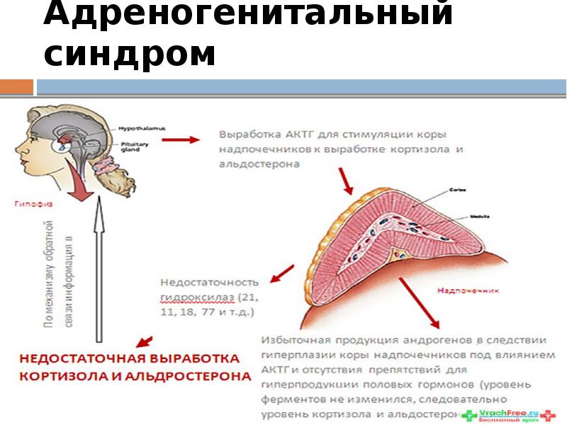 Адреногенетический синдром фото