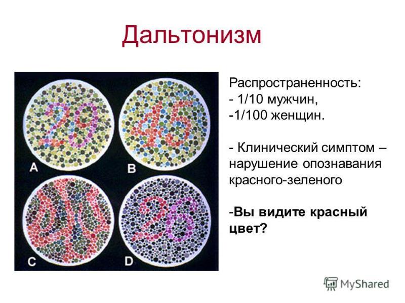 Есть женщины дальтоники. Дальтонизм. Проявление дальтонизма. Дальтонизм это болезнь. Дальтонизм наследственное заболевание.