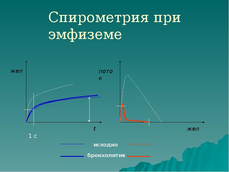 Спирометрия при эмфиземе Спирометрия при эмфиземе
