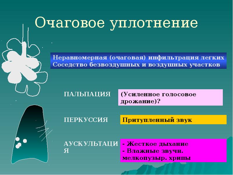 Очаговое уплотнение Очаговое уплотнение