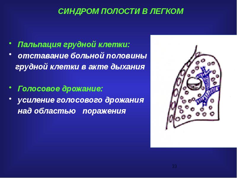 Синдромы легких. Синдром полости в легком. Синдром полости в легких. Синдром полости в легком пропедевтика. Грудная клетка при синдроме полости.