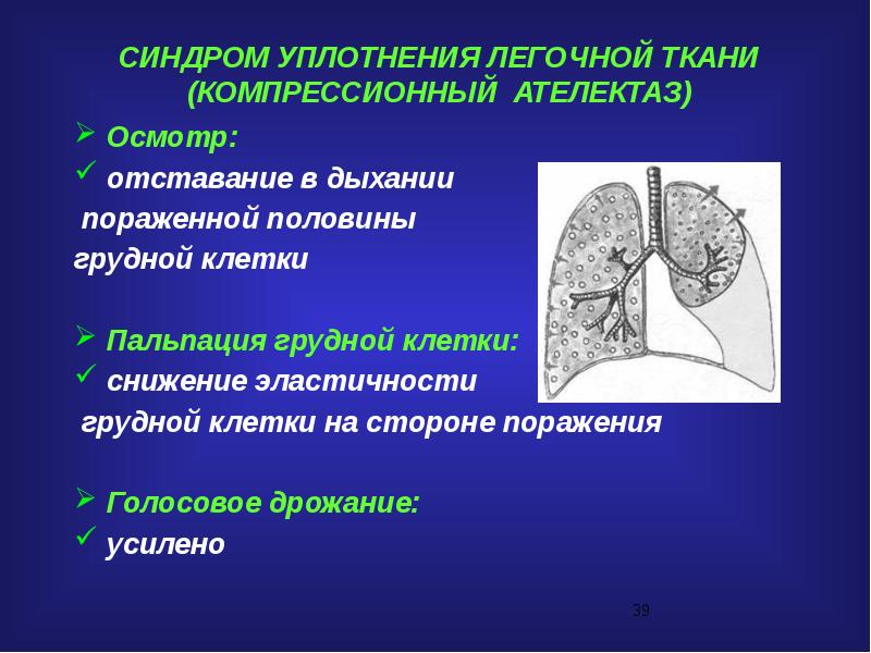 Уплотнение ткани. Уплотнение легочной ткани. Синдром уплотнения легочной ткани. Уплотнение легочной ткани на рентгене. Синдром уплотнения легочной ткани рентген.