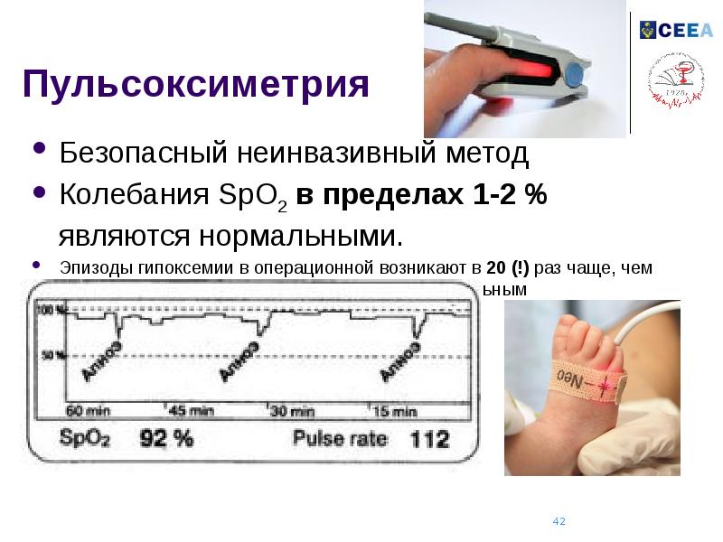 Пульсоксиметрия это. Пульсоксиметрия принцип метода. Пульсоксиметр spo2 норма. Пульсоксиметрия гипоксемия. Сатурация spo2 норма.