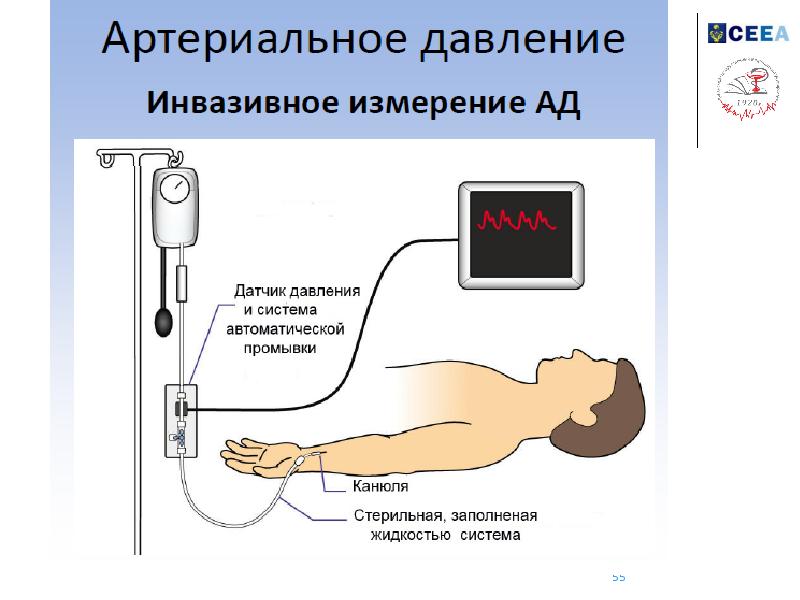 Мониторинг во. Измерение артериального давления алгоритм. Артериальное давление алгоритм. Измерение артериального давления алгоритм действий. Измерение ад алгоритм.