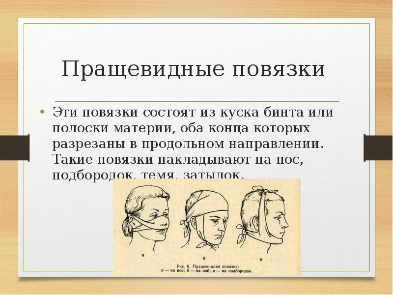 Повязка это. Пращевидная повязка алгоритм. Пращевидная повязка на темя. Пращевидная повязка на затылок. Виды повязок презентация.