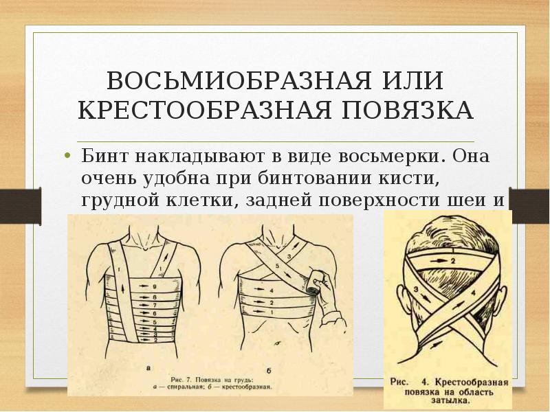 Дополните схему об основных видах бинтов средние