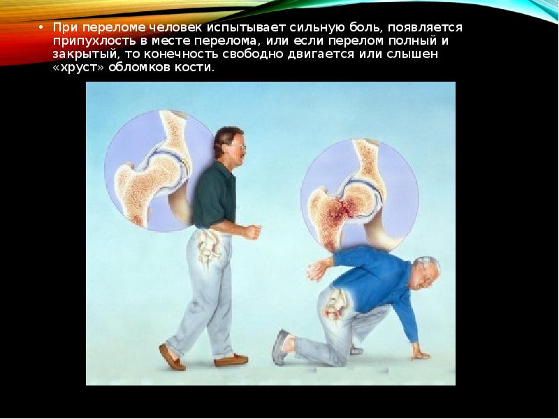 При переломе человек испытывает сильную боль, появляется припухлость в месте перелома,