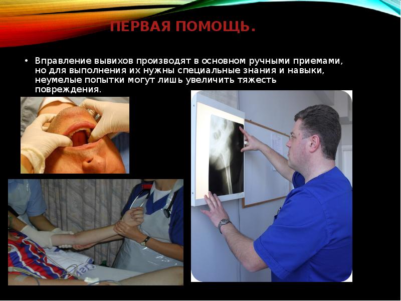 Первая помощь. Вправление вывихов производят в основном ручными приемами, но для