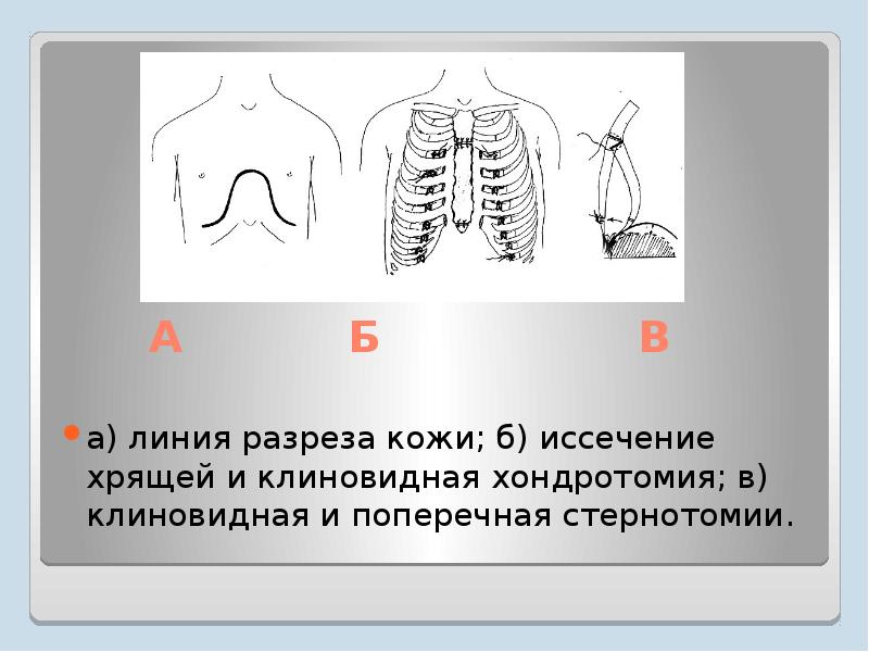 Индексы грудной клетки. Индекс эрисмана. Показатель эрисмана показатели. Индексы грудной клетки. Воронкообразная деформация грудной клетки рентген.