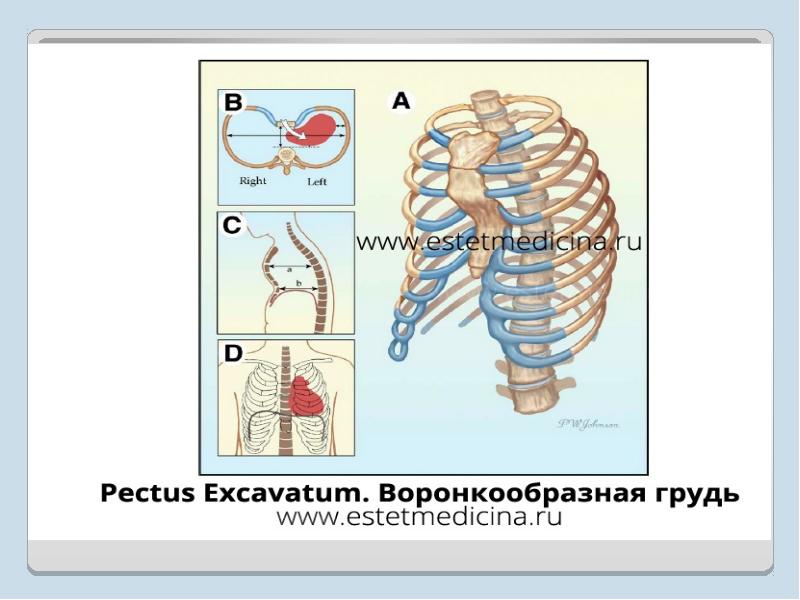 Топография грудной клетки презентация