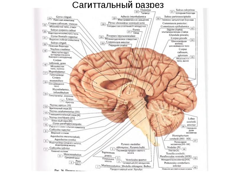 Сагиттальный разрез головного мозга рисунок с подписями