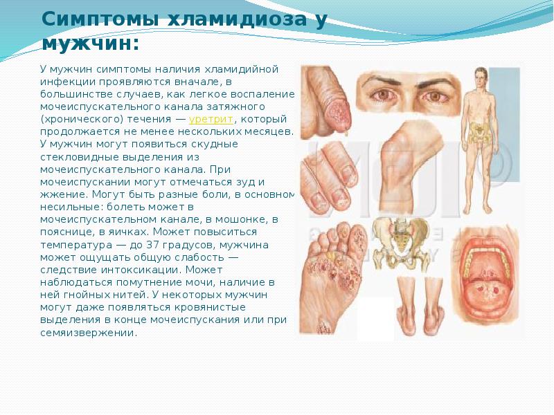 Хламидиоз хронический лечение схема