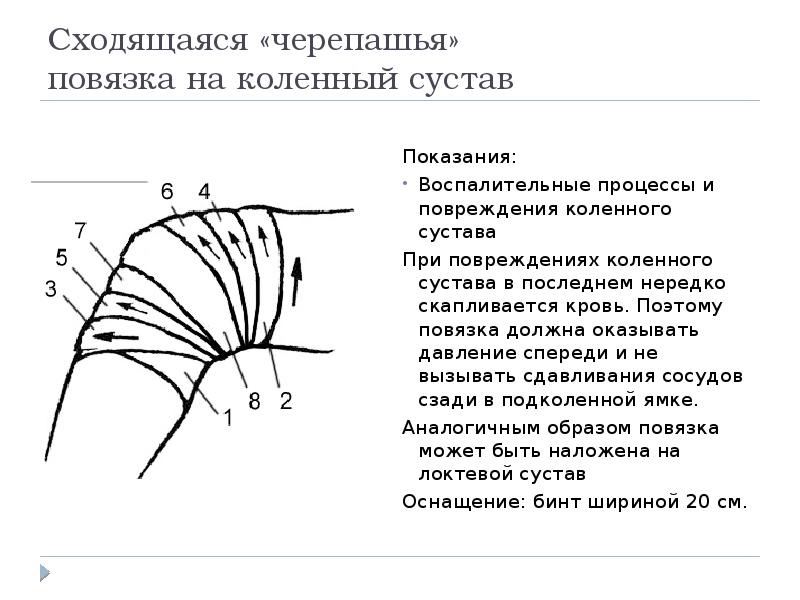 Повязка на локоть схема