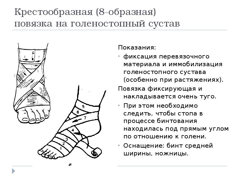 План рассказа почему повязка на ноге