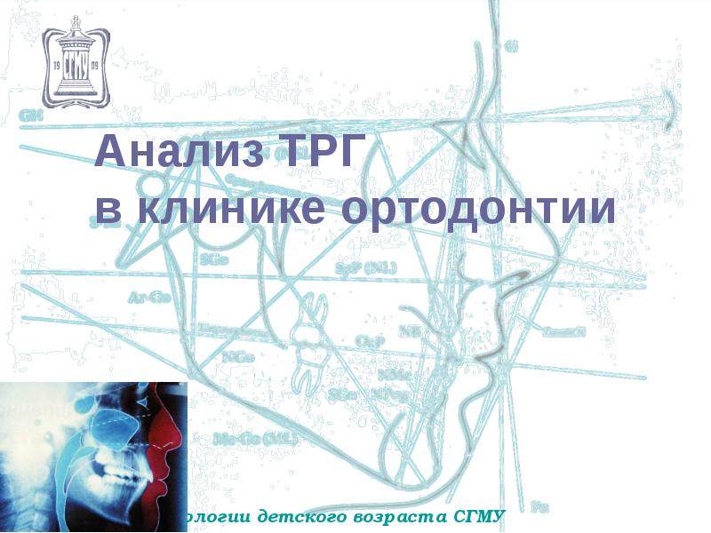 Анализ ТРГ в клинике ортодонтии Анализ ТРГ в клинике ортодонтии