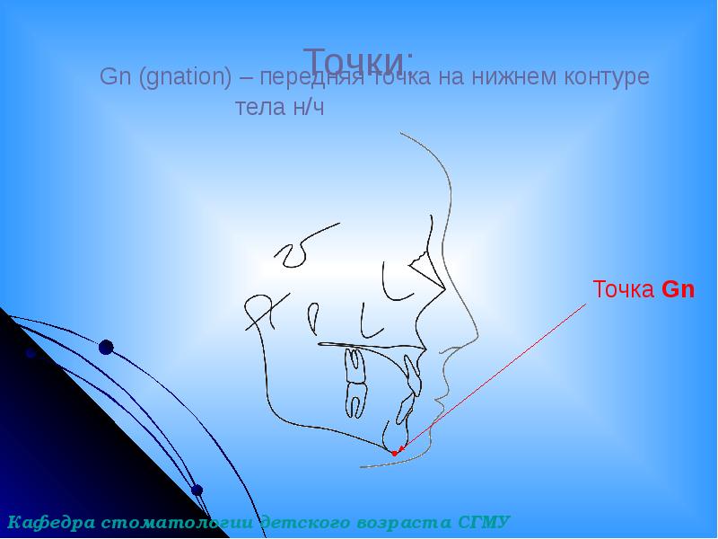 Точки:
Gn (gnation) – передняя точка на Точки:
Gn (gnation) – передняя точка на