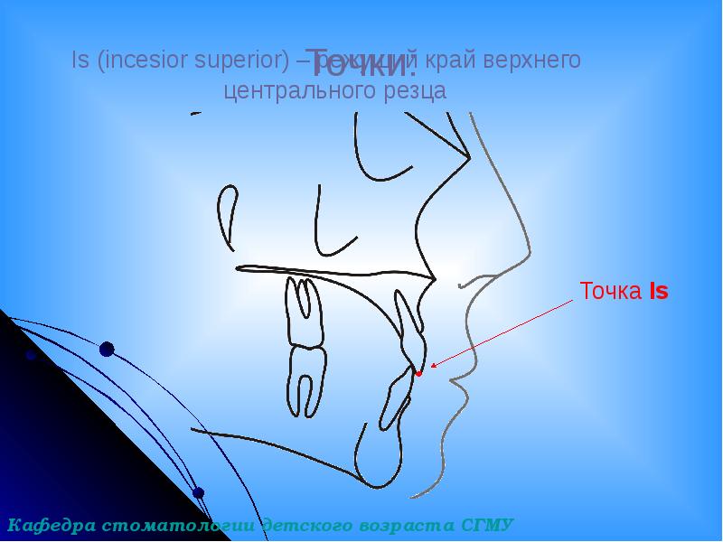 Точки:
Is (incesior superior) – режущий край верхнего Точки:
Is (incesior superior) – режущий край верхнего