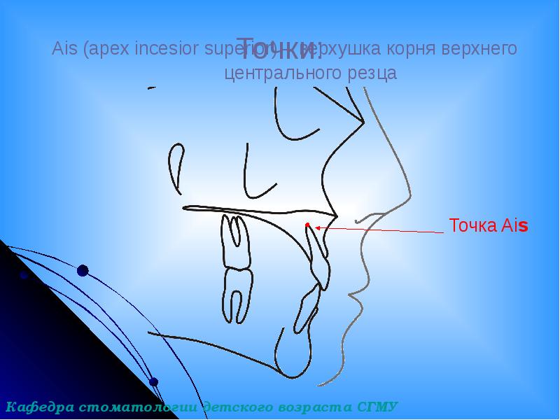 Точки:
Ais (apex incesior superior) – верхушка корня верхнего Точки:
Ais (apex incesior superior) – верхушка корня верхнего