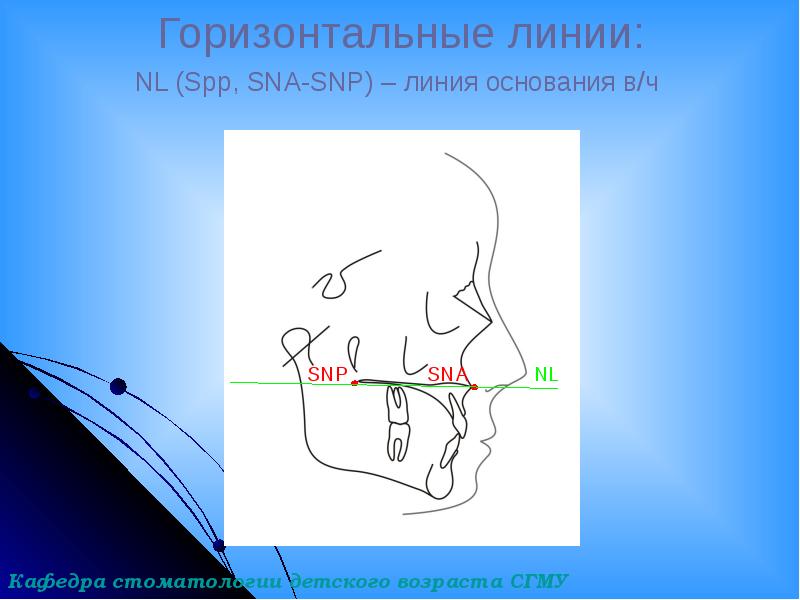 Трг в ортодонтии презентация