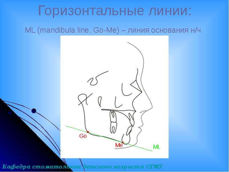 Трг в ортодонтии презентация