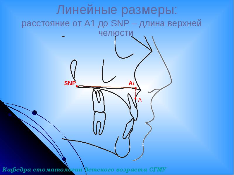 Линейные размеры:
расстояние от А1 до SNP – длина верхней Линейные размеры:
расстояние от А1 до SNP – длина верхней