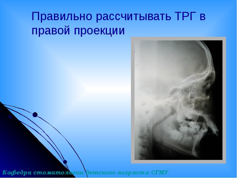 Правильно рассчитывать ТРГ в правой проекции Правильно рассчитывать ТРГ в правой проекции