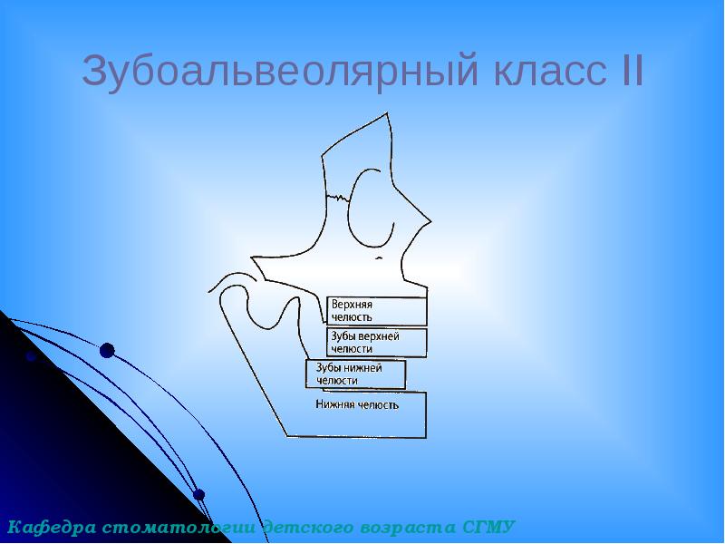 Зубоальвеолярный класс II Зубоальвеолярный класс II