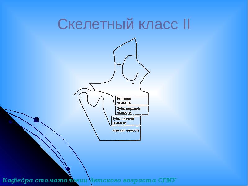 Скелетный класс II Скелетный класс II