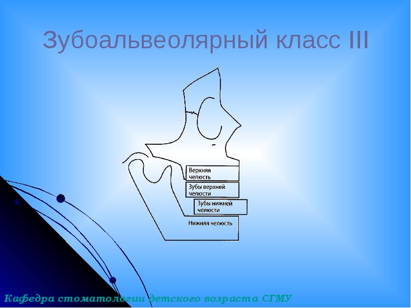 Зубоальвеолярный класс III Зубоальвеолярный класс III