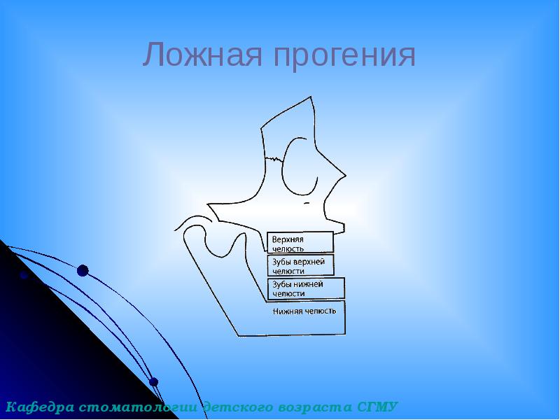 Ложная прогения Ложная прогения