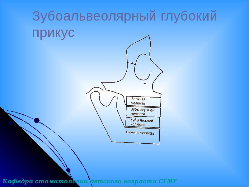 Зубоальвеолярный глубокий прикус Зубоальвеолярный глубокий прикус