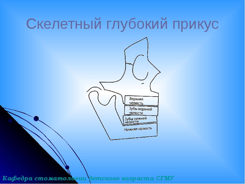 Скелетный глубокий прикус Скелетный глубокий прикус