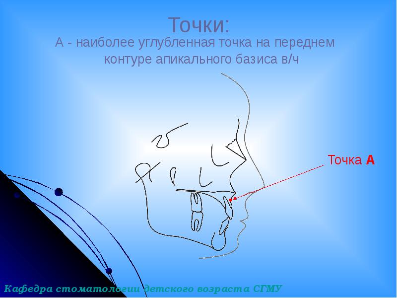 Точки:
А - наиболее углубленная точка на Точки:
А - наиболее углубленная точка на